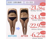 アフリオーラ はなみずき店(affriolant)/ビフォーアフター