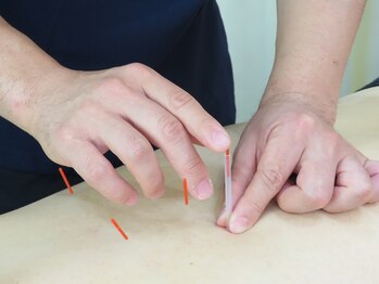 プラネット鍼灸整骨院/鍼灸施術