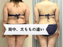 アンジュ(Ange)/ハミ肉！撃退！！