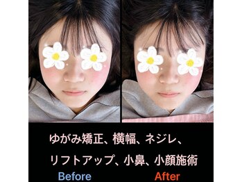 美容矯正サロン レレポノ(LELEPONO)/