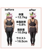 おいけ美容整体院 太田藪塚院/産後ダイエット