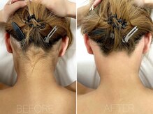 エヴァワックス 恵比寿店(Eva Wax)/【うなじ】ビフォーアフター