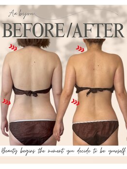 エイエービジュー(Aa.bijou)/