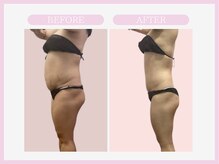 アコガレコガオ 秋田店/