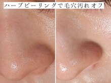 ユウビジン(YOU美人)/