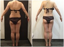 美容整体ウェリナ 名駅院/小顔矯正/骨盤矯正/美脚サロン