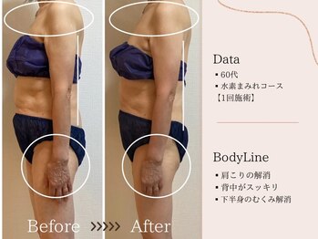 ヨサパーク すずのね(YOSA PARK)/水素まみれコース・姿勢も改善