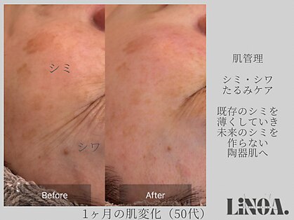 リノアドット(LiNOA.)の写真