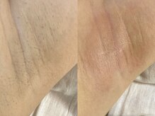 モア30(more30)の雰囲気（産毛、角質ケアで理想のつるすべ肌に☆トーンアップを叶えます*）