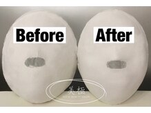 美極 銀座店/銀座/小顔コルギ/小顔矯正