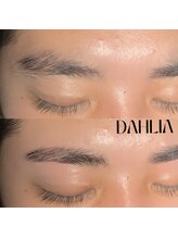 ダリア(Dahlia)/眉毛のワックス脱毛