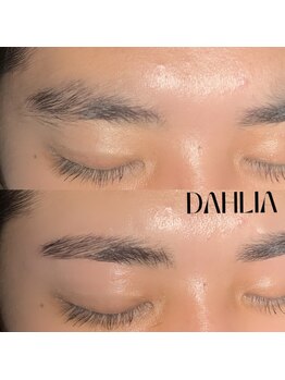 ダリア(Dahlia)/眉毛のワックス脱毛