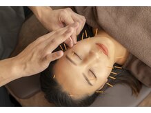 健康堂整骨院 大倉山新院/美容鍼むくみ 大倉山/大倉山駅】