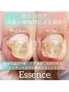 お悩み改善☆足爪リペア