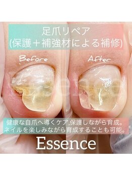 エッセンス (Essence)/お悩み改善☆足爪リペア