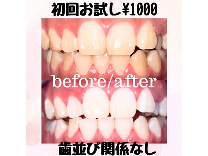 ホワイトサロンの写真