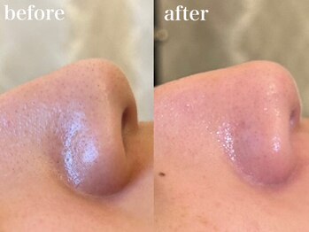 ベティ(Betty)/ラレステンエステ