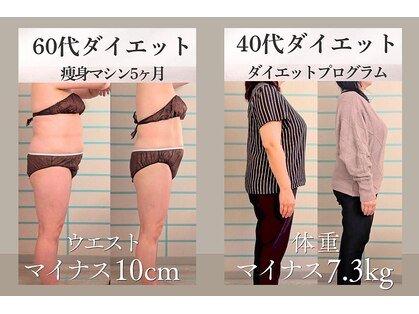 ハナメ(HANAME)の写真