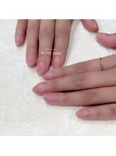 リッシュ ドゥ(RICHE deux)/ちゅるん☆先端ゴールドフレンチ