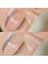 メル(me'r.)/ハリウッドブロウリフト