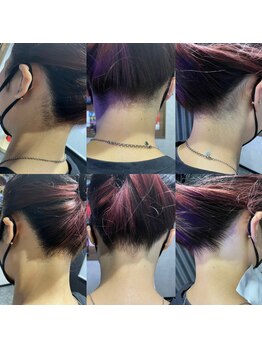 メンズー(MENZOO)/うなじ脱毛