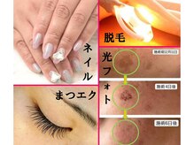 ベルジェ(Bellje)の雰囲気（多彩ネイル♪早いまつエク♪効果実感脱毛♪大人気光フォト♪）