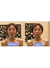 アジール 長岡リバーサイド千秋店(agir)/Before/After画像