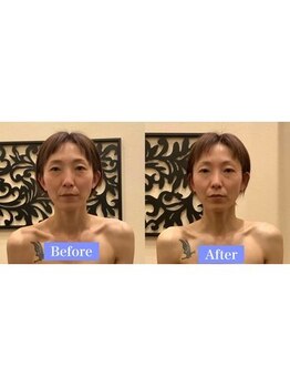 アジール 長岡リバーサイド千秋店(agir)/Before/After画像