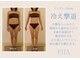 リタ(RITA)の写真