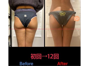 美尻研究所 福岡大名店/ヒップアップ!