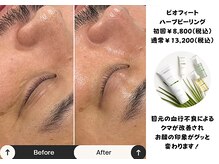 メグル(MEGURU)の雰囲気（男性にもおすすめなフェイシャルケアは営業職の方必見です）