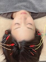 ユーフォリア(Euphoria)/頭皮鍼