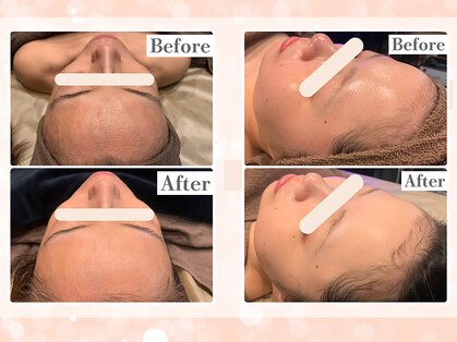 フレイヤ(FREYA)の写真