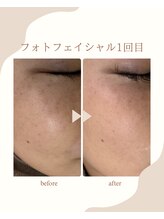 シャルム(Charme)/