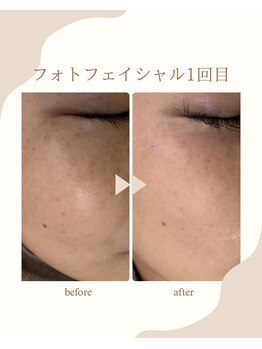 シャルム(Charme)/