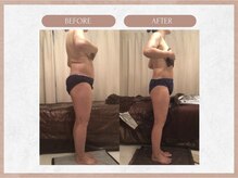ソウイボディ 川崎本店(Sou-i body)/お客様before after#痩身#小顔