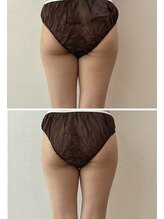 ラブランフェアリー/１回でも驚きの変化！