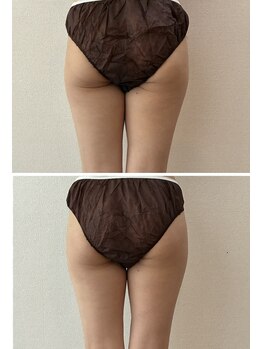 ラブランフェアリー/１回でも驚きの変化！