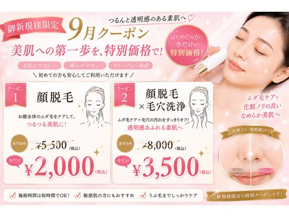 ポリー(Polly)の写真