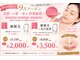 ポリー(Polly)の写真