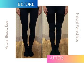 ナチュラルビューティーフェイス 横浜(NBF)/骨盤矯正/O脚矯正/X脚矯正/横浜