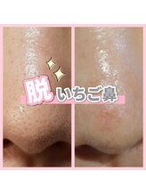 サロン(SALON)/ララピール+LDM