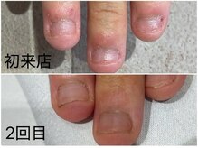 グレースレディ 神戸北店/