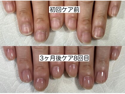 ネイルサロンアンドスクール マルベリー(mulberry)の写真