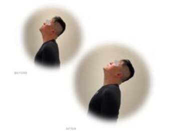 整体ライト 仙台ハピナ名掛丁店(整体LIGHT)/頸部可動域改善のbefore & after