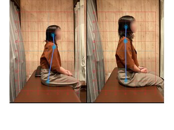 整体院 長谷川/姿勢改善でマイナス5歳！