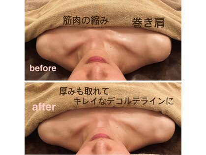 ミオ(mio)の写真