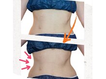 ヨサパーク ハーブチャーム(YOSAPARK herb charm)の雰囲気（温めて内臓から整え巡りUPでしっかり美しいくびれへ導きます♪）