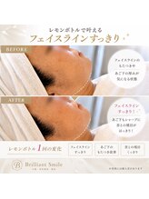 ブリリアントスマイル/与那原で人気のレモンボトル