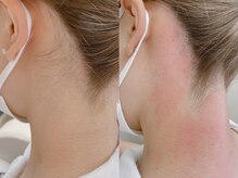 ネイル アンド アイラッシュ グレイス(Grace)/うなじのWAX脱毛